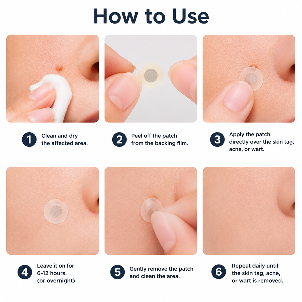 ✨Curalona® 2-in-1 Microneedle & Hydrocolloid Patch🍀 | Removes raised moles, acne, flat warts, and skin tags | Helps improve wrinkles, scars, and blemishes | Invisible patches for face and body