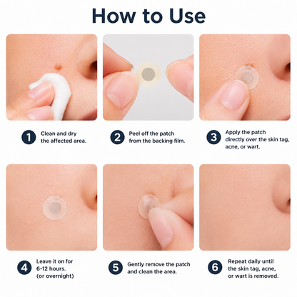 ✨Curalona® 2-in-1 Microneedle & Hydrocolloid Patch🍀 | Removes raised moles, acne, flat warts, and skin tags | Helps improve wrinkles, scars, and blemishes | Invisible patches for face and body