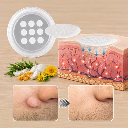 ✨Curalona® 2-in-1 Microneedle & Hydrocolloid Patch🍀 | Removes raised moles, acne, flat warts, and skin tags | Helps improve wrinkles, scars, and blemishes | Invisible patches for face and body